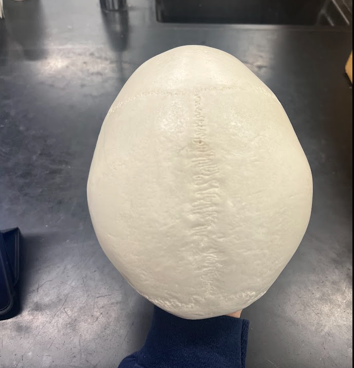 Superior view of skull cap showing cranial sutures