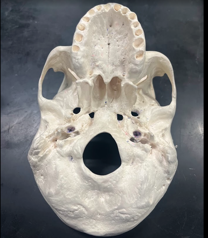 Inferior view of cranial base with foramen magnum