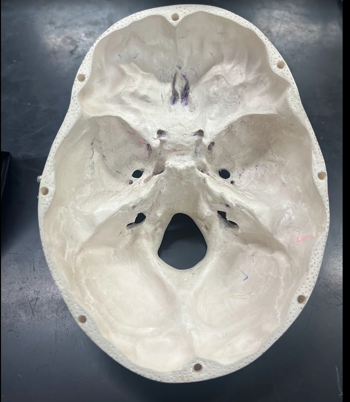 Internal cranial fossae where the brain sits